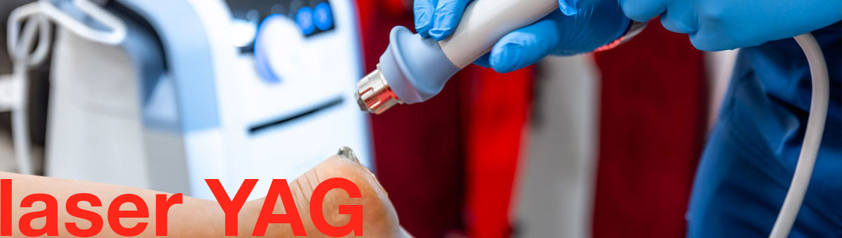 laser-YAG-postural-project