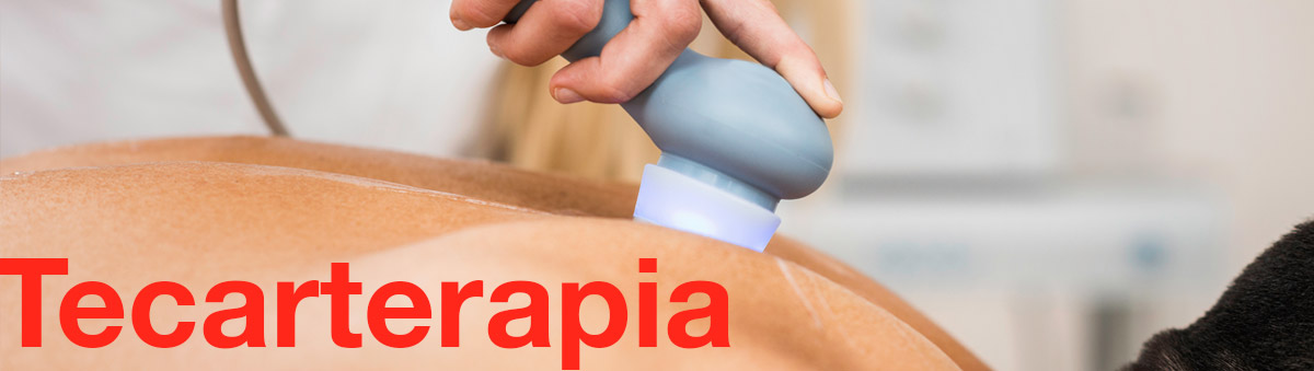 tecarterapia-postural-project